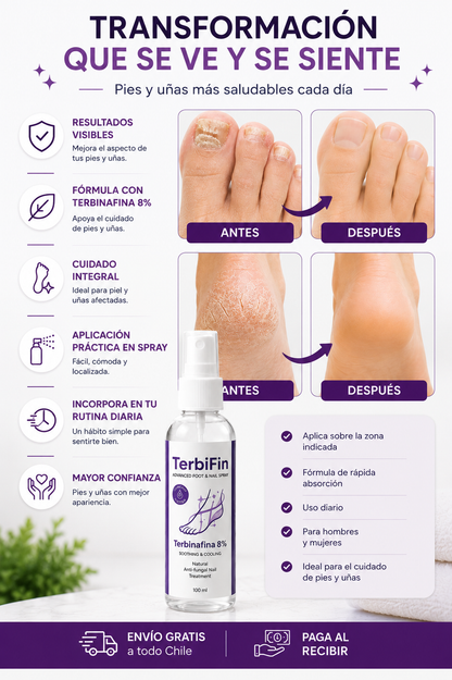 TerbiFin Spray Cuidado Intensivo para Pies y Uñas