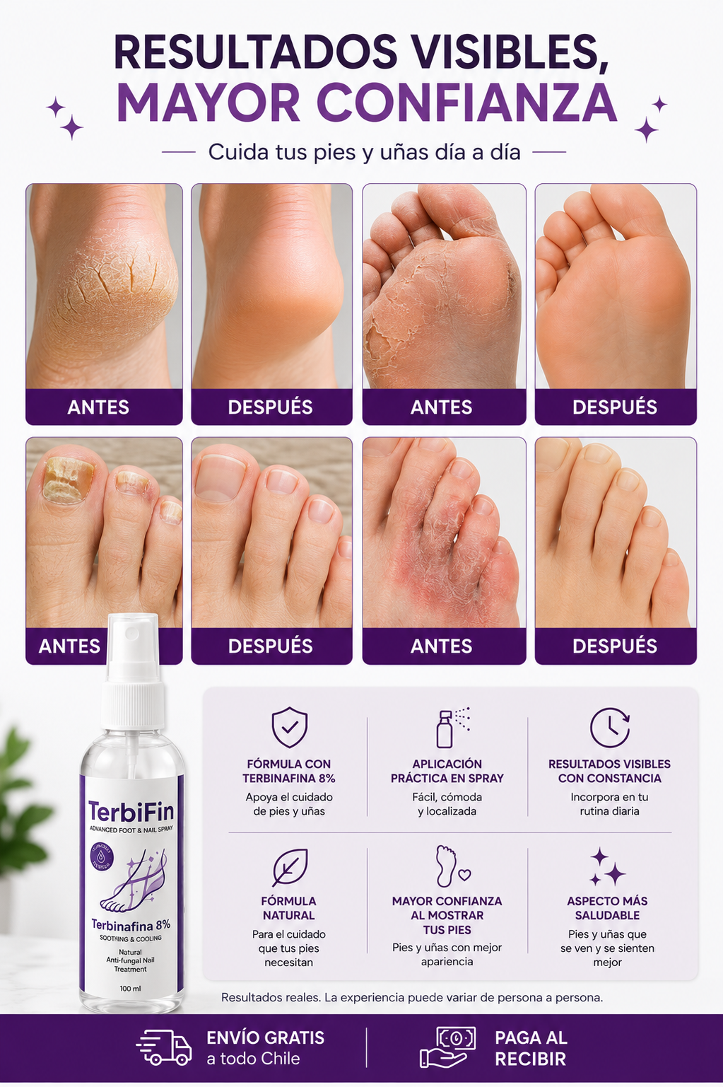 TerbiFin Spray Cuidado Intensivo para Pies y Uñas